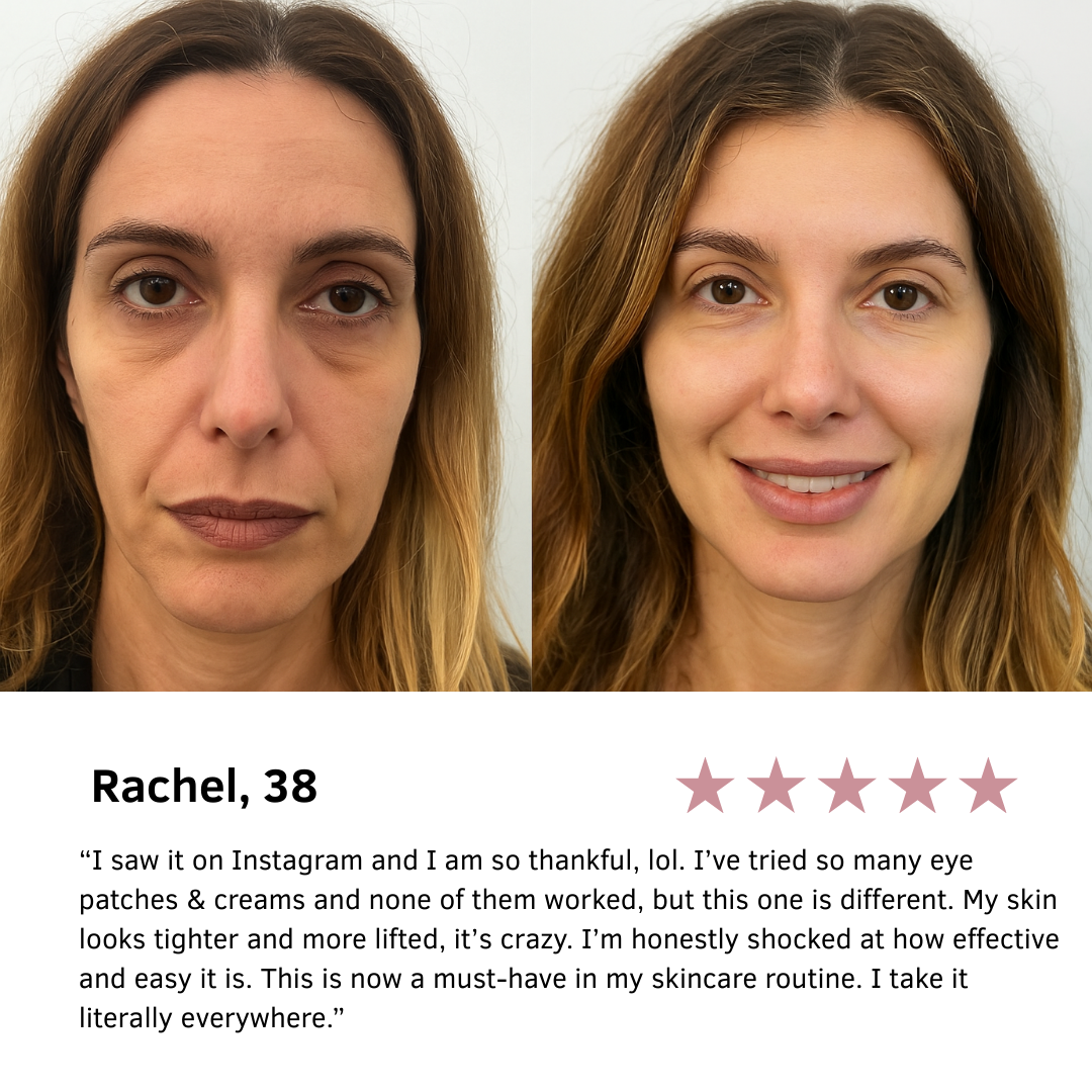 Needling Eye Patches