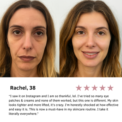 Needling Eye Patches
